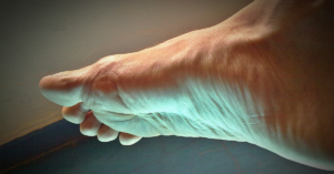 a patient's numb foot during a neuropathy evaluation in Midvale, UT